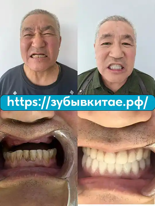 До и после — кейс 2