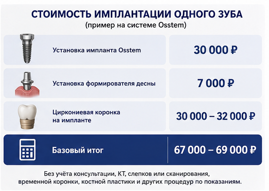 Стоимость имплантации одного зуба в Реутове на системе Osstem