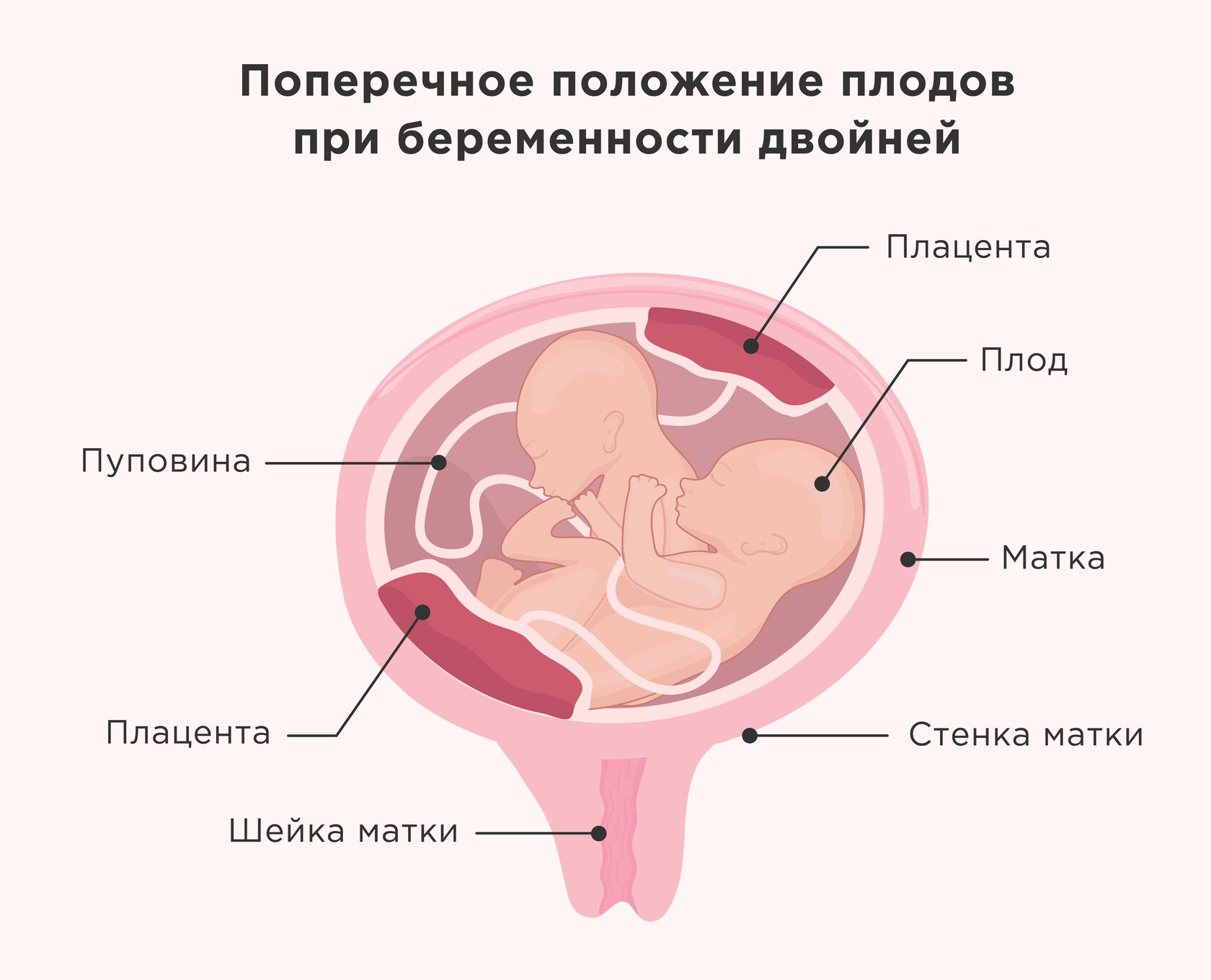 Планирование беременности: как зачать близнецов