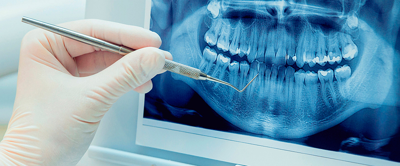 Кт ОПТГ ТРГ аппарат. Стоматологическая 3d томография Sirona телерентгенограмма. Рентгенологическое исследование зубов.