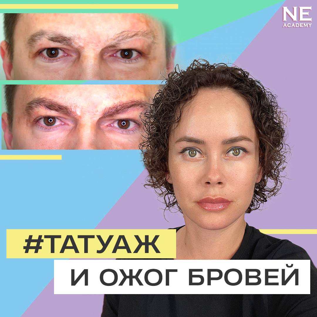 Татуаж и ожог бровей