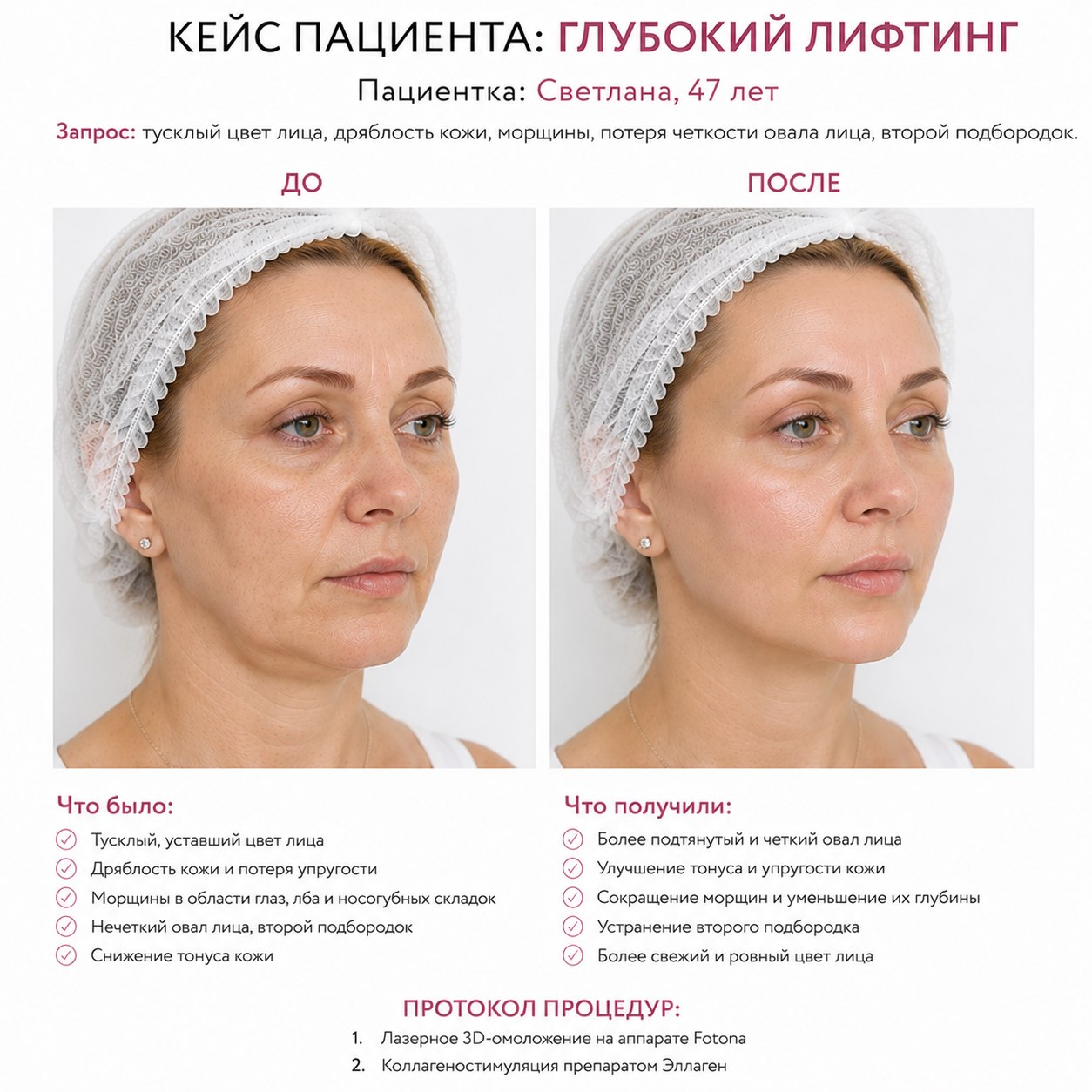 Кейс пациента до и после