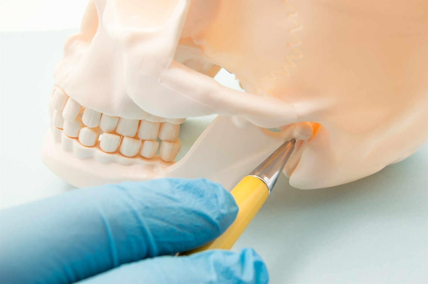 Отстроченная реплантация зуба после вывиха как причина полной резорбции