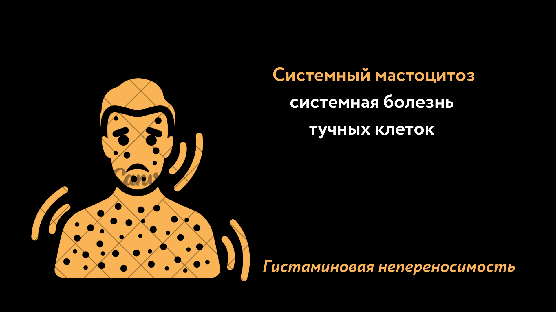 Системный мастоцитоз, системная болезнь тучных клеток, гистаминовая непереносимость, дефицит ДАО, диаминоксидаза, нистамин, пищевая аллергия, питание при аллергии