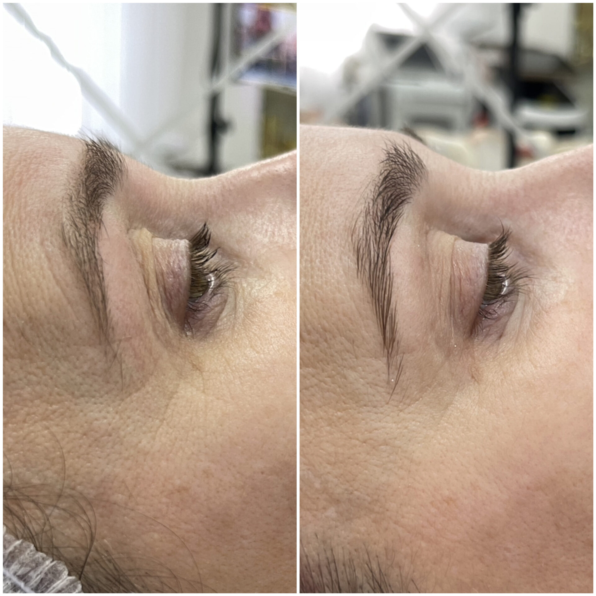 ДО/ПОСЛЕ ЭСТЕТИЧЕСКИХ ПРОЦЕДУР