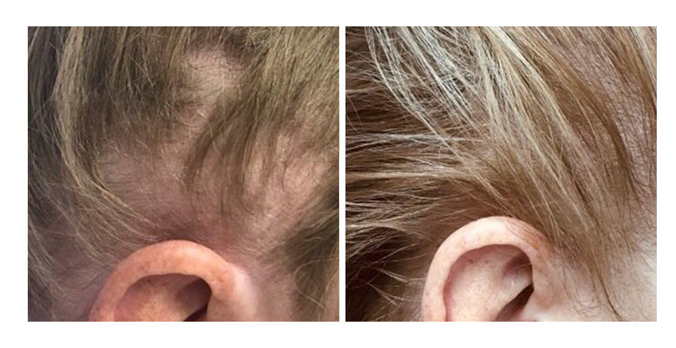 Hella 167x107. после w. после w. слова на w. после w.