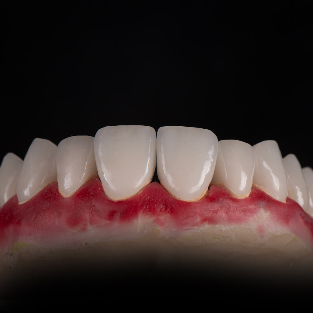 Зуботехническая лаборатория москва