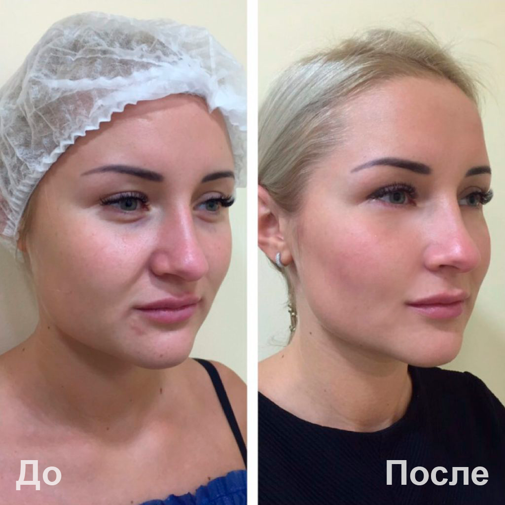 Лицензия 3