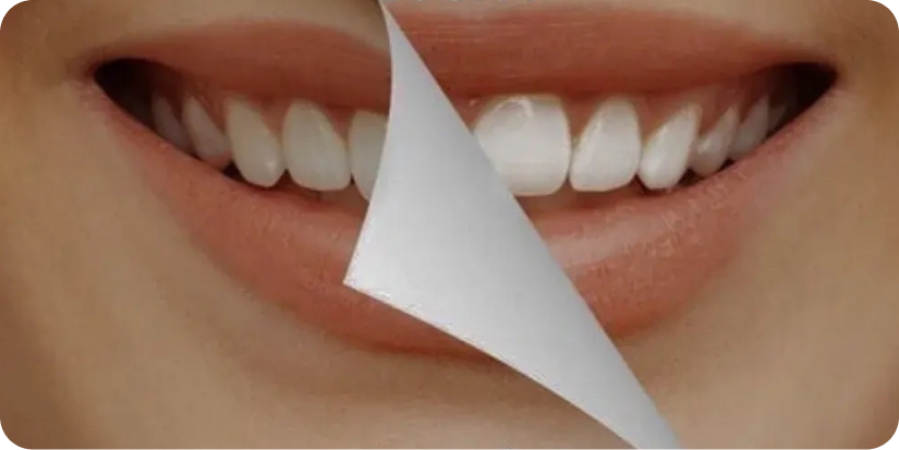 -15% на профессиональное отбеливание зубов ZOOM4