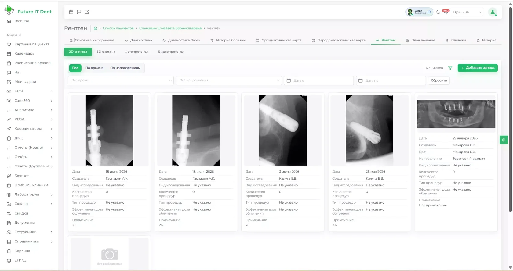 Просмотр КЛКТ в Future IT Dent