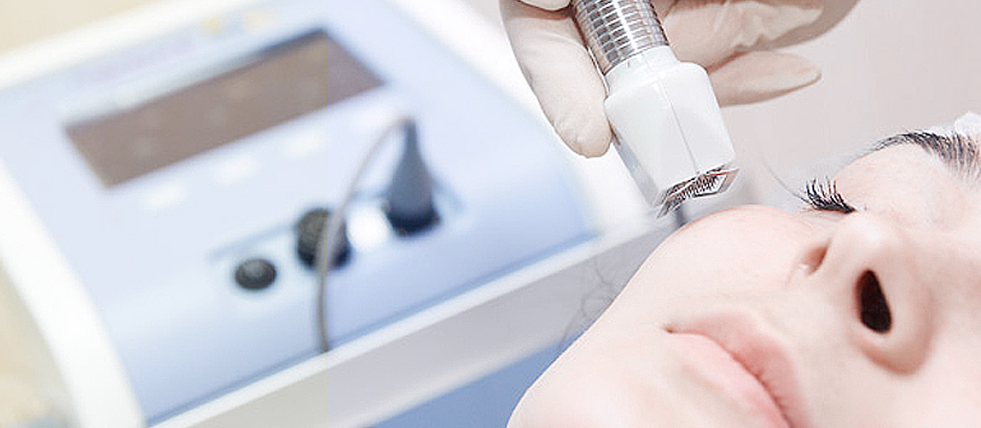 Микроигольчатой омоложение. Микроигольчатой омоложение. Микроигольчатой омоложение. Микроигольчатой омоложение. Микроигольчатой омоложение.