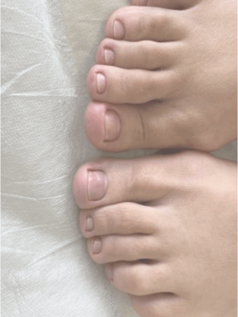 Педикюр после