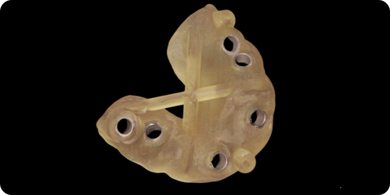 Хирургический шаблон