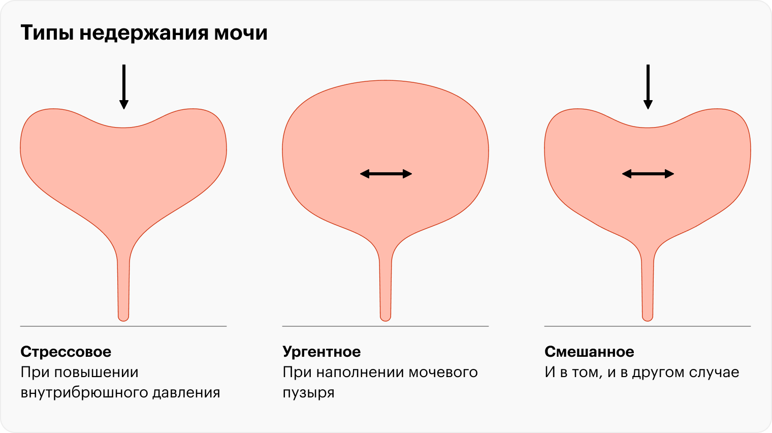 Ургентность мочеиспускания. Частые и болезненные позывы к мочеиспусканию. Задержка мочеиспускания у детей.