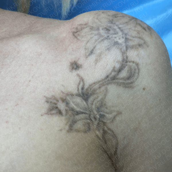 Разработана новая технология – татуировки без иголок