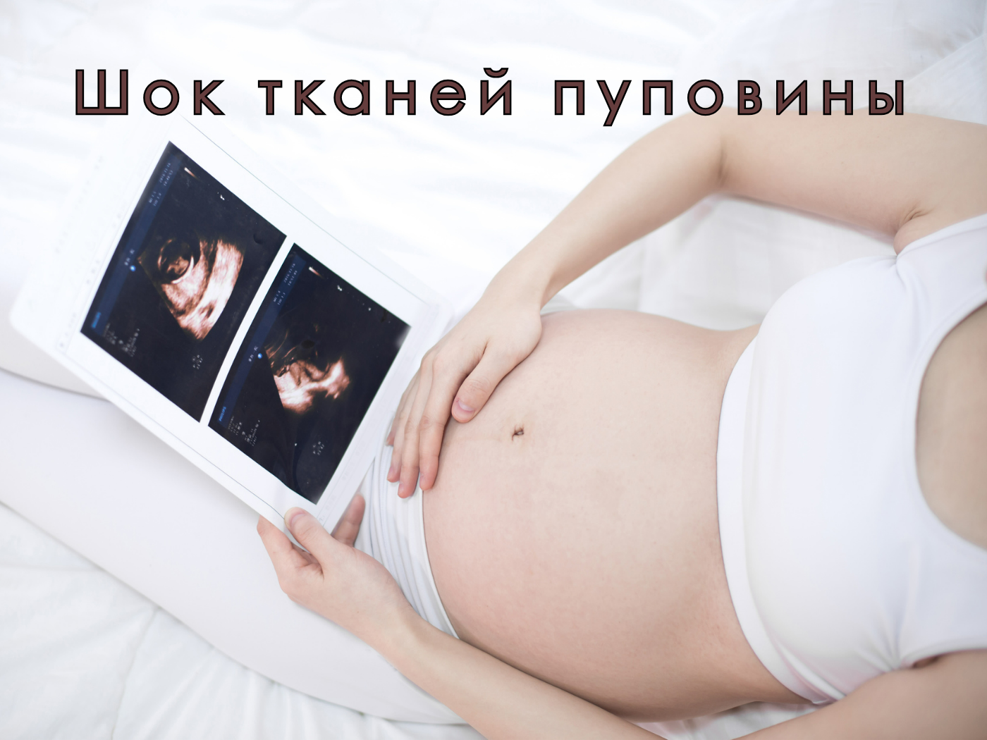 Шок тканей пуповины
