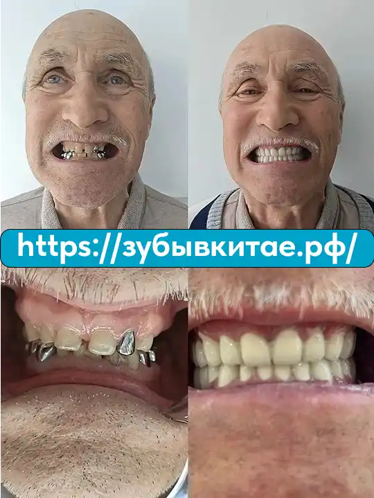 До и после — кейс 13