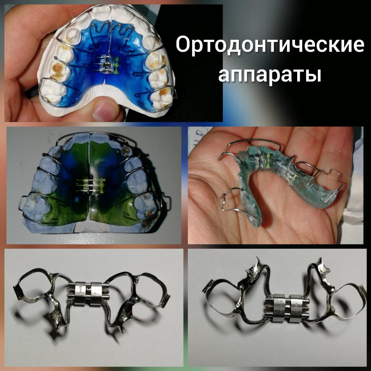 Ортодонтические аппараты механического действия презентация