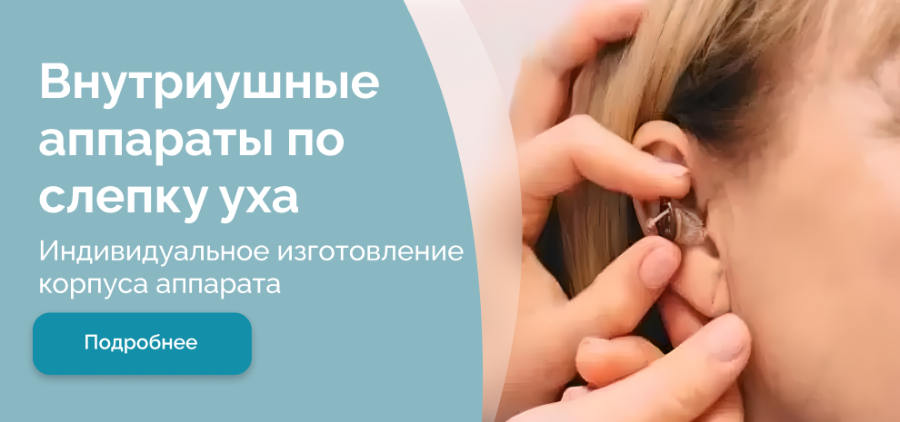 Внутриушные слуховые аппараты - купить в Москве по выгодной цене