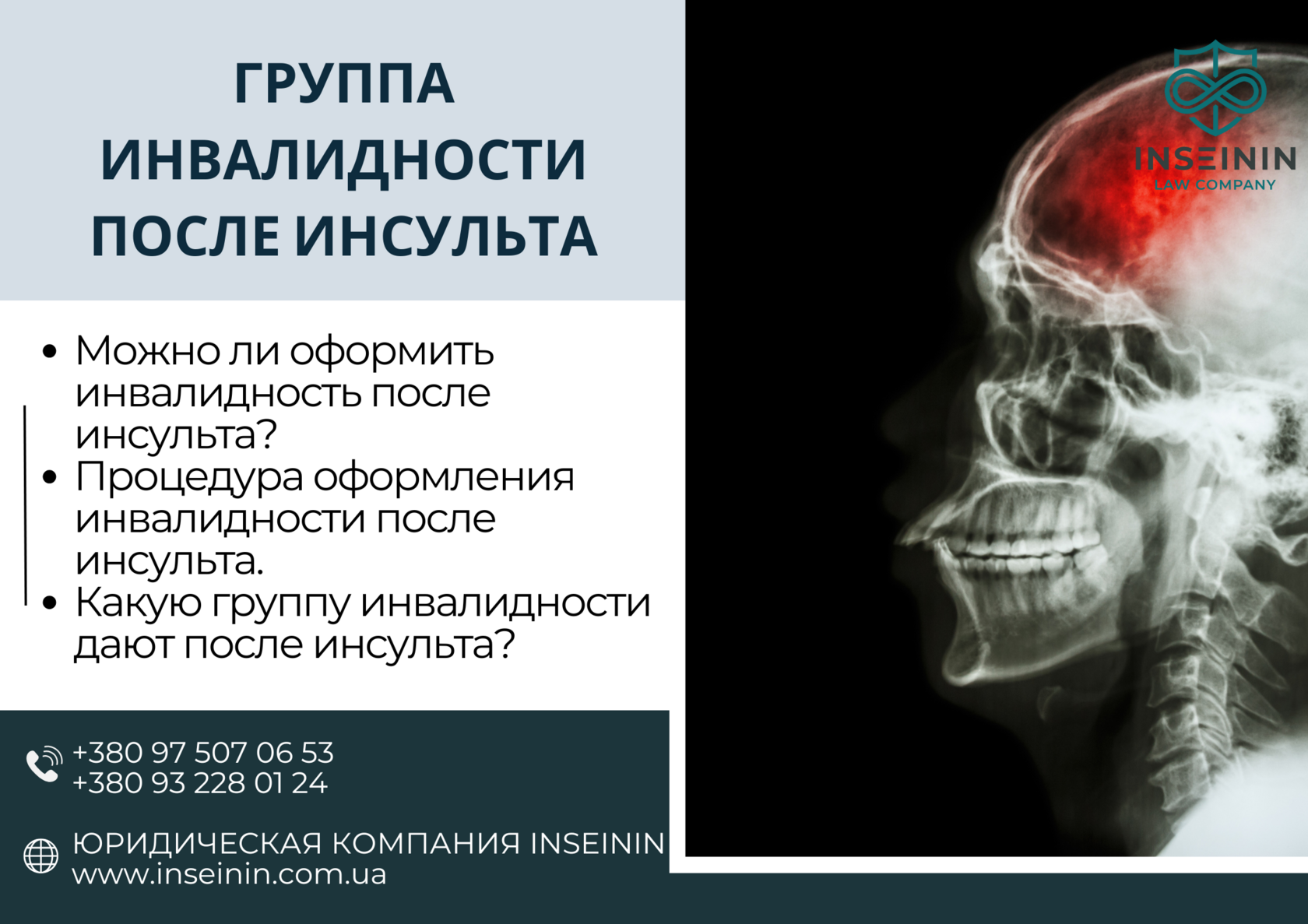 Группа инвалидности после инсульта