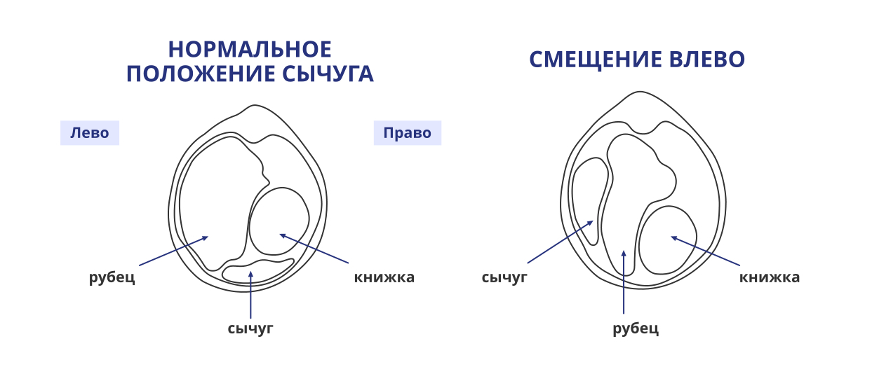 Смещение сычуга. Причины смещения сычуга у коровы. Причины смещения сычуга.