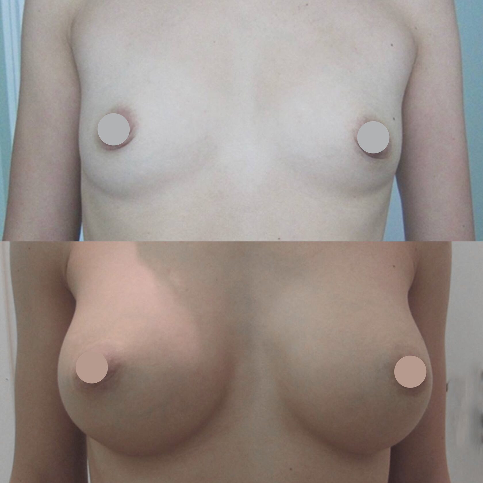 изменение груди с возрастом у женщин фото 83