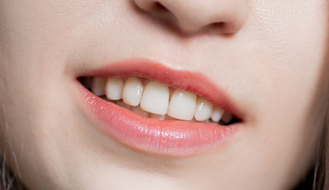 Эстетическая реставрация зубов