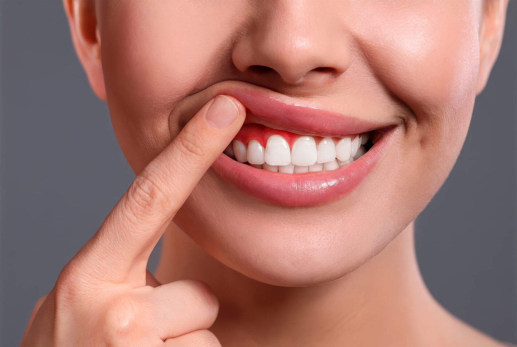 Оголение корней зубов – не только эстетический дефект