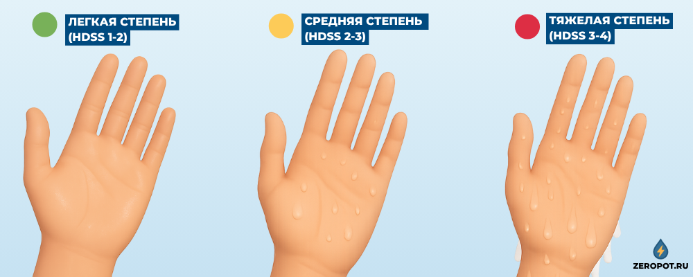 Три степени тяжести гипергидроза рук - легкая, средняя и тяжелая форма потливости ладоней