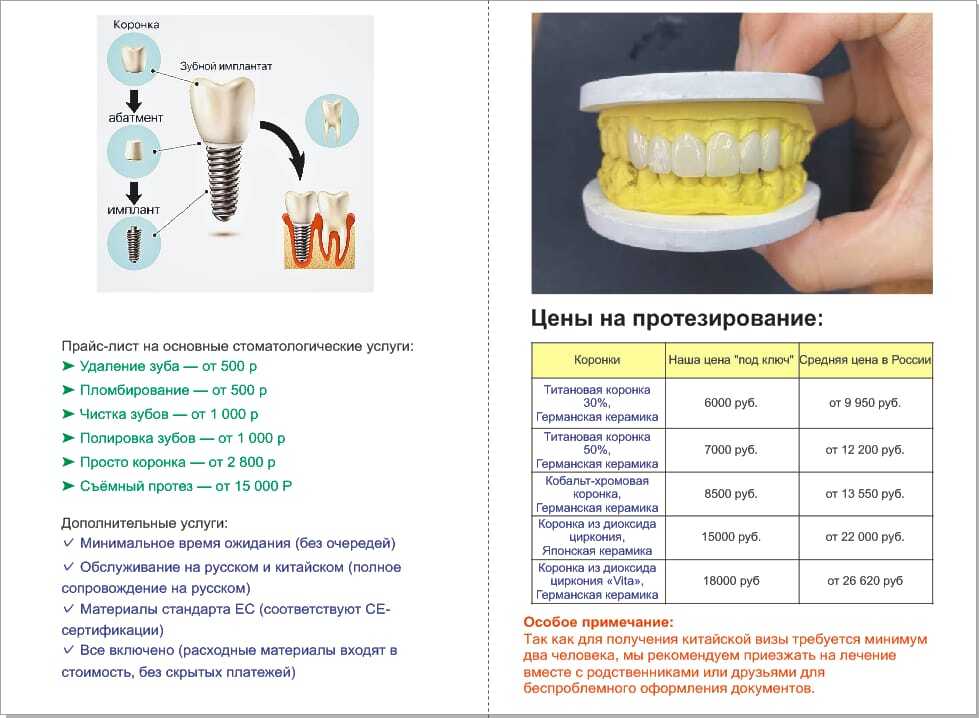 цены на лечение зубов в китае