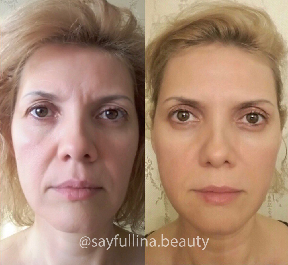 Вебинар о профессии Бьюти-тренер