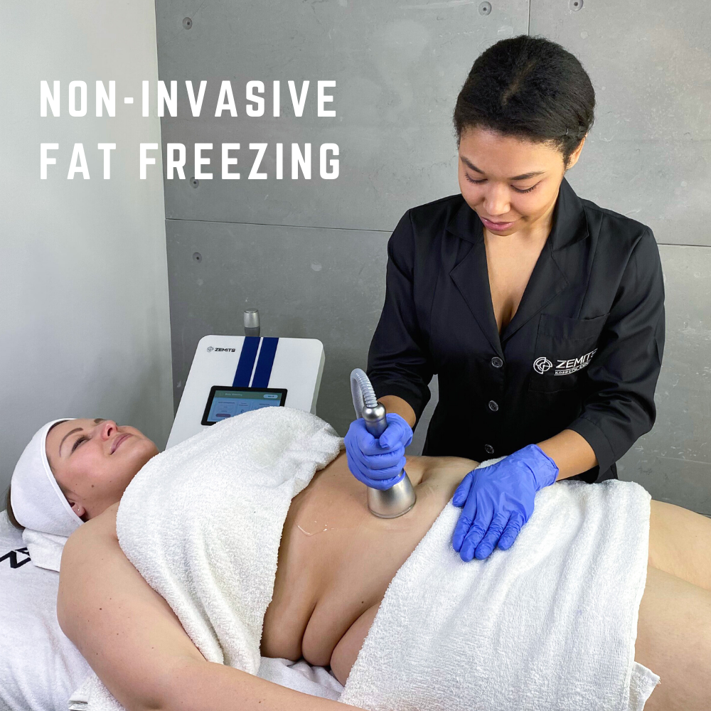 Everything you need to know about the coolsculpting machine