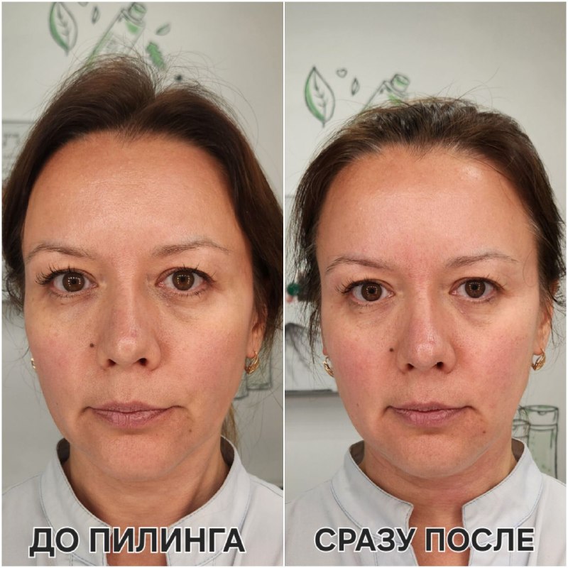 Мои любимчики в деле: пилинги ALCEDO