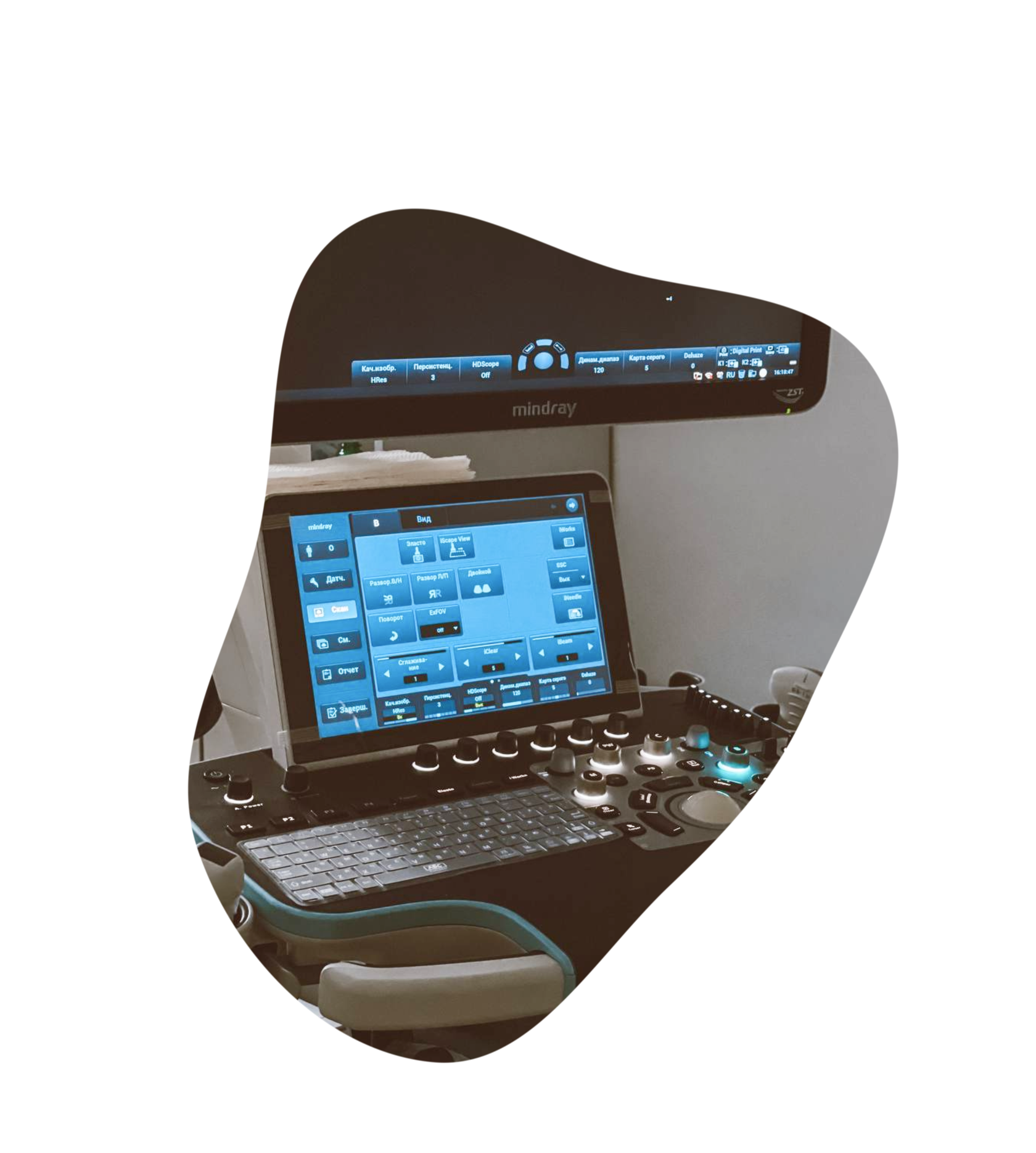 узи сосудов первичная консультация