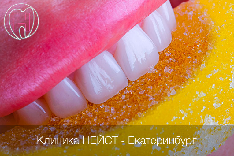 Керамические виниры в Екатеринбурге