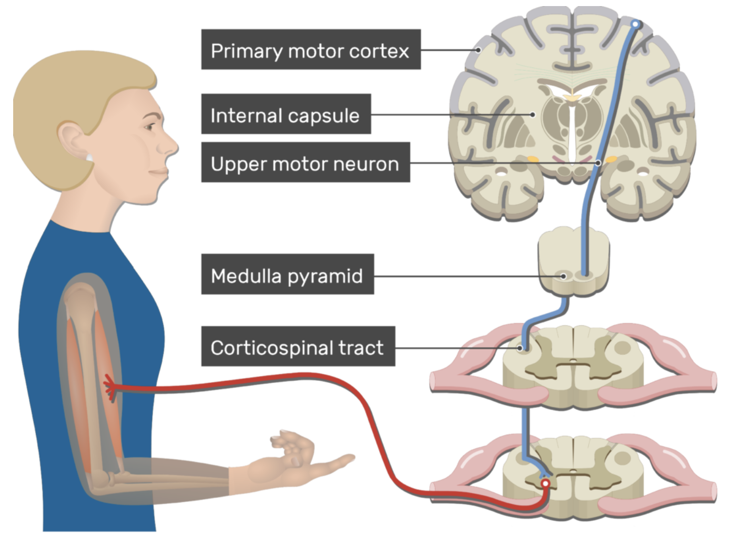 Ein Bild, das Gelenk enthält.
KI-generierte Inhalte können fehlerhaft sein.