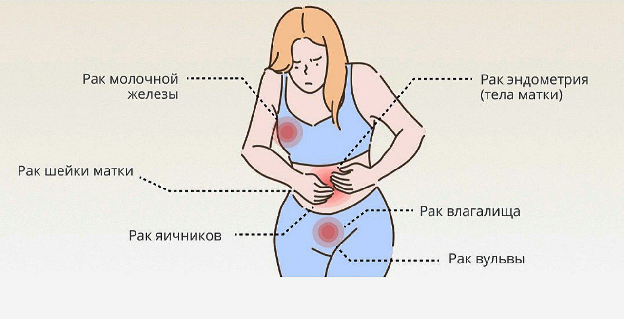 Симптомы рака | Признаки онкологии у мужчин и женщин | Центр интегративной  медицины