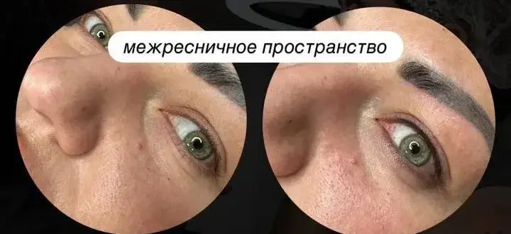 Межресничное пространство до и после перманентного макияжа