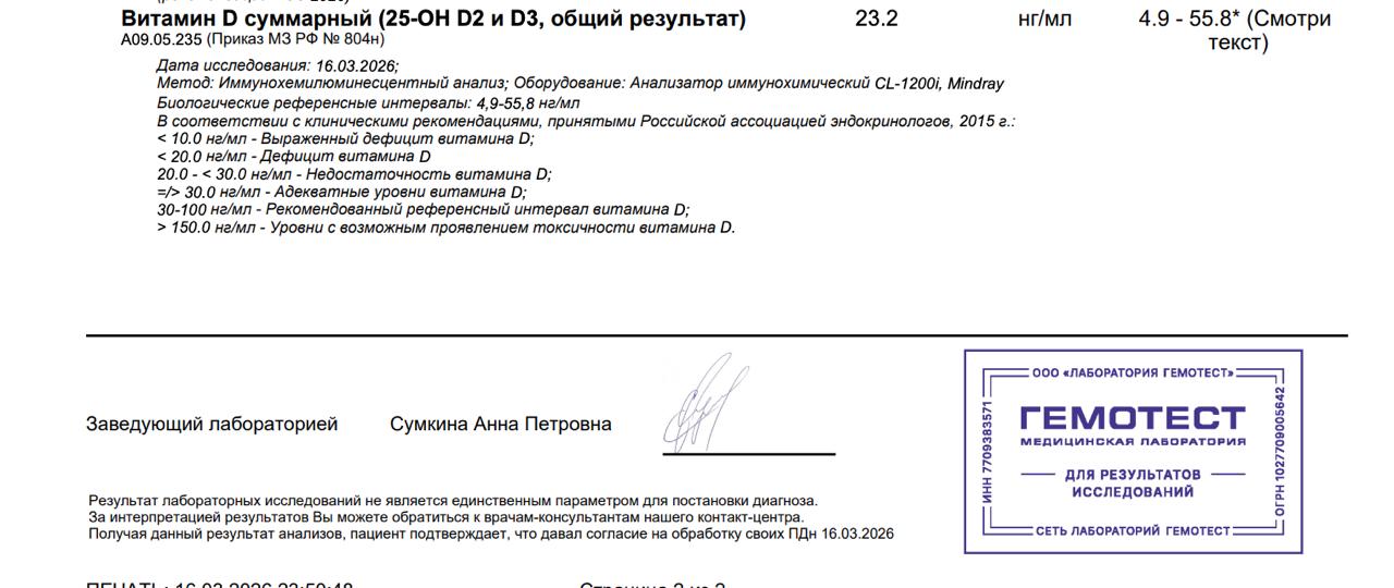 Анализ витамин D до — 23.2 нг/мл