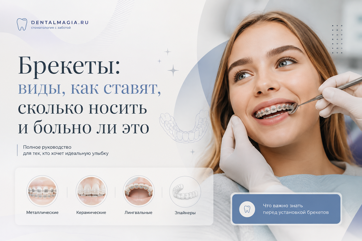 Брекеты: виды, как ставят, сколько носить и больно ли это