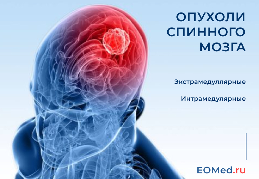 Воспаление головного мозга. Энцефалит головного мозга. Токсический энцефалит. Энцефалит воспаление мозга.