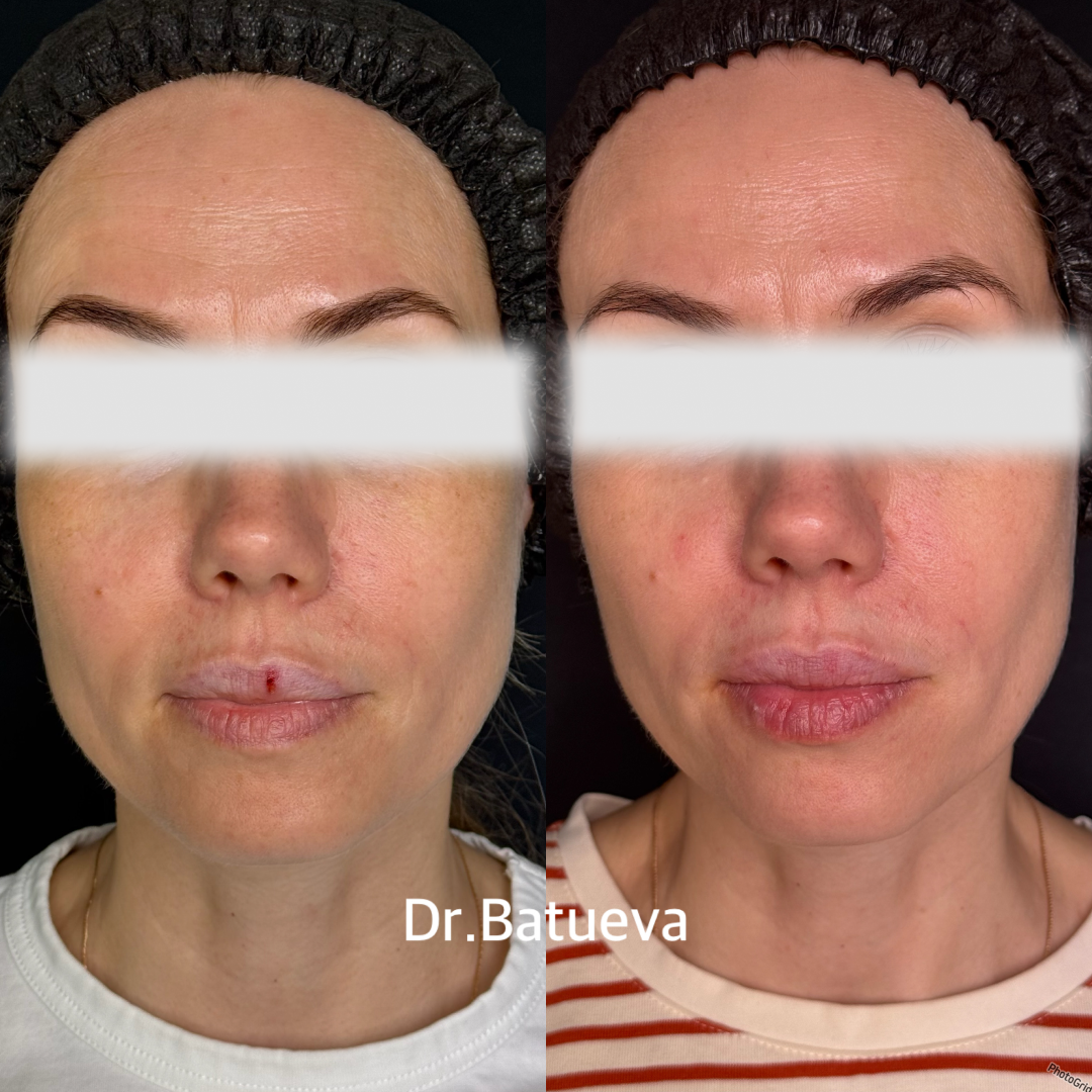 Результат Healthy Glow до и после, пример 5