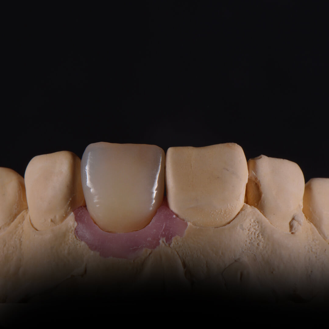 Зуботехническая лаборатория москва