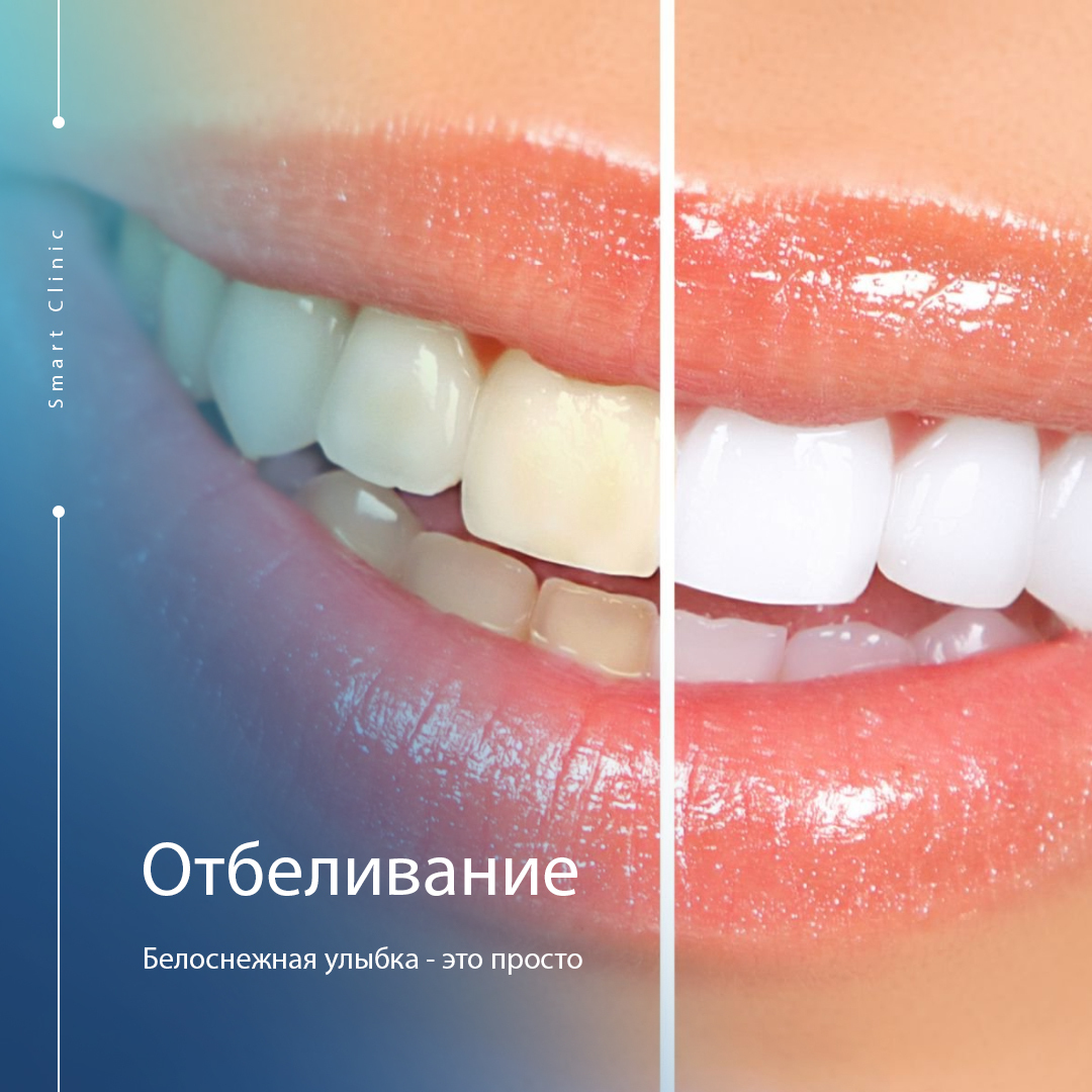Фото до и после стоматологии ГАРАНТ