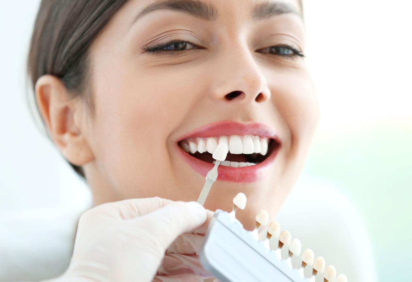 Что такое виниры в стоматологии