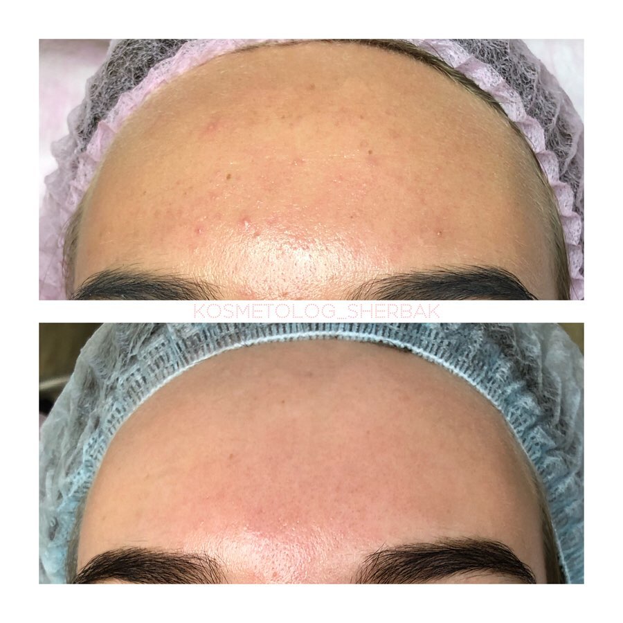 Индивидуальный подбор домашнего ухода в клинике PradusCOSMO, Санкт-Петербург. Косметологический анализ кожи и рекомендация профессиональной косметики