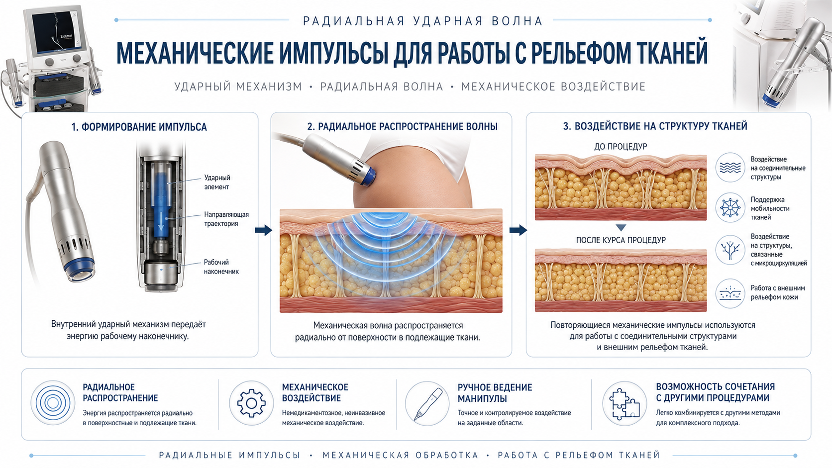 Схема механизма Z Wave