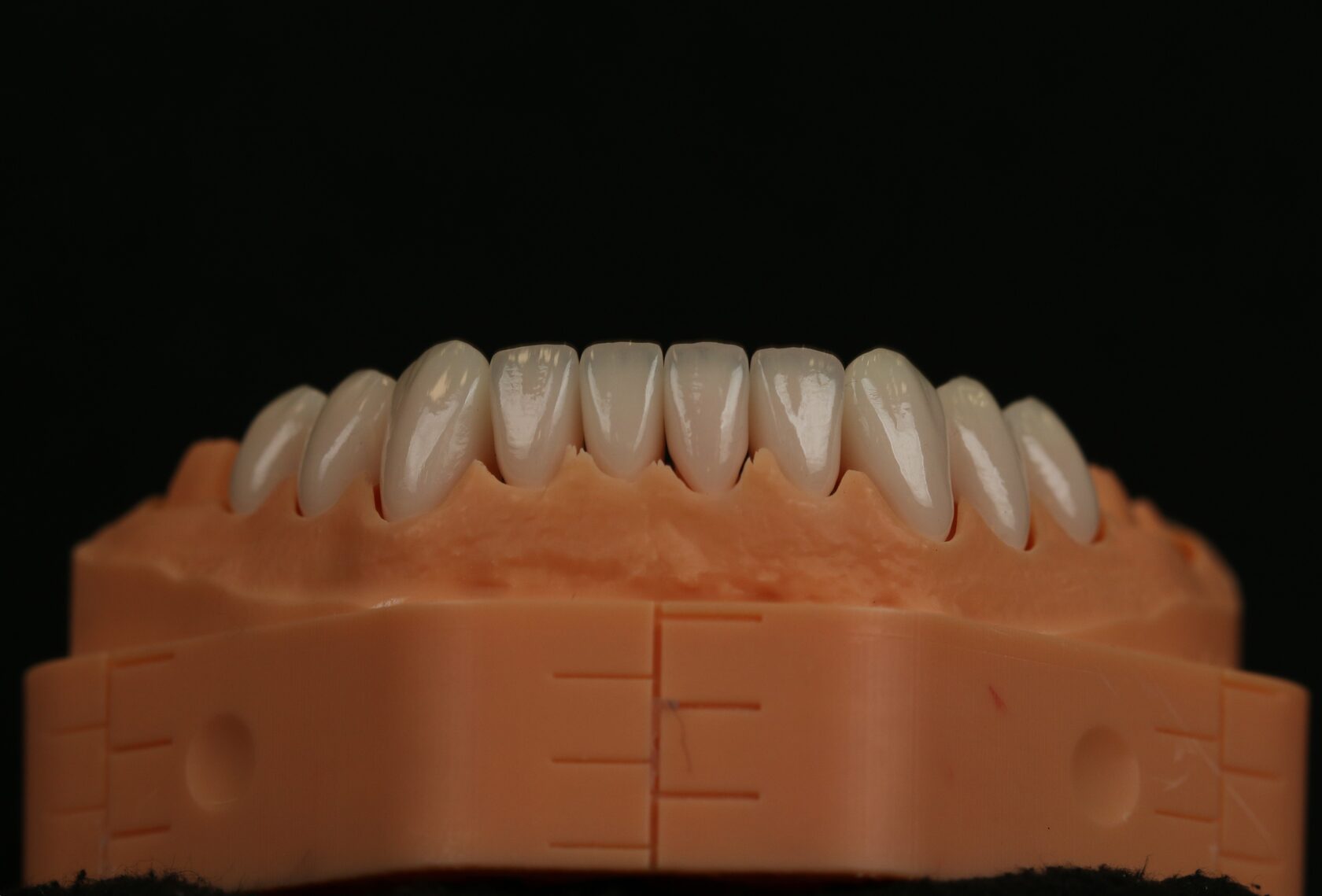 Нет зуба — изменения прикуса и лица: решение в Пробел Москва