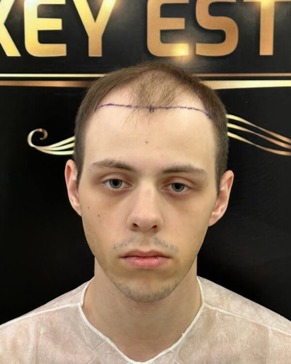 После