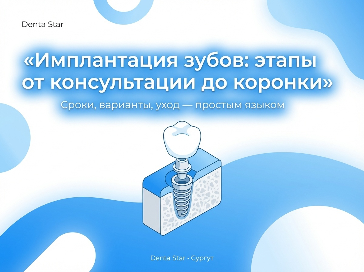 Имплантация зубов в Сургуте — как проходит лечение: этапы, сроки, варианты, уход
